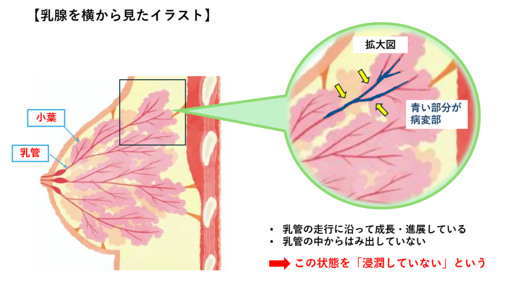【乳腺を横から見たイラスト】