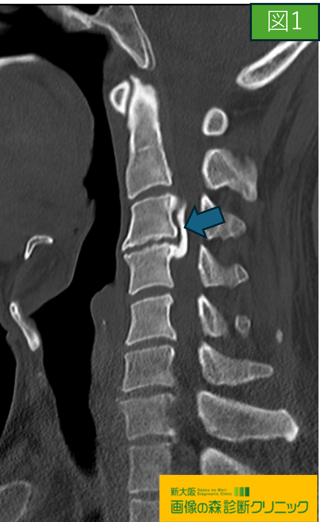 症例画像1
