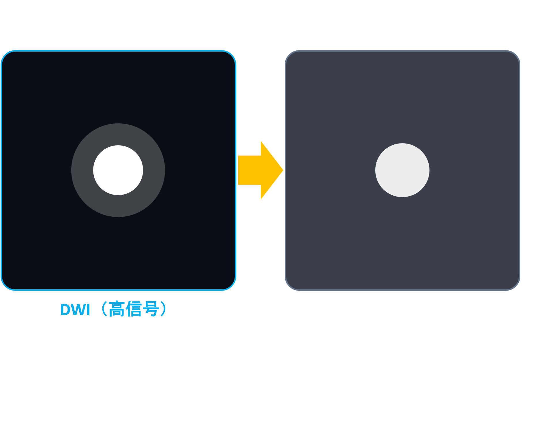 T2 shine-throughのDWIとADC比較