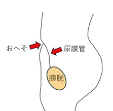 尿膜管の位置を示したイラスト